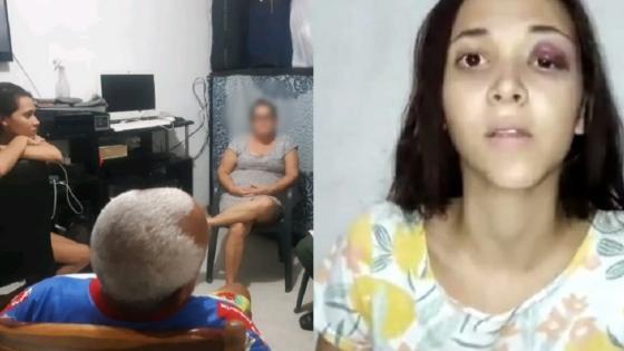 Así sobrevivió Arelys Naranjo a la brutal golpiza que le propinó su exnovio