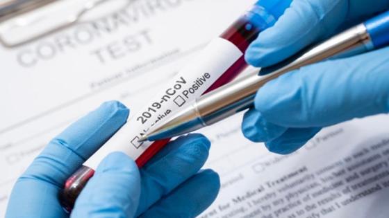 casos nuevos de coronavirus en Colombia