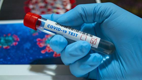 Pruebas de Coronavirus en Colombia