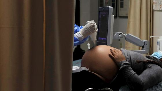 Brasil reporta aumento de muertes en mujeres embarazadas por Covid-19 Brasil reporta aumento de muertes en mujeres embarazadas por Covid-19