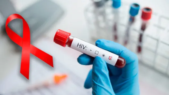 Nuevo método de prevención contra el VIH se ensaya en Sudáfrica