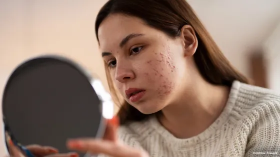 Effaclar Duo