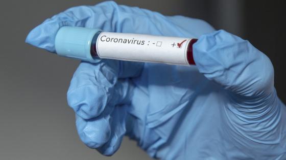 Coronavirus en Cali