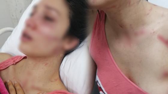  intento de feminicidio contra Angélica Zapata en Circasia