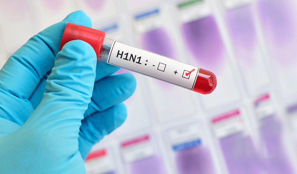Nuevo caso de AH1N1 en Colombia